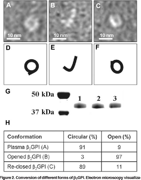 Figure 2 From Beta2 Glycoprotein I Can Exist In 2 Conformations