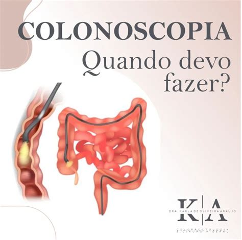 Colonoscopia Quando Fazer