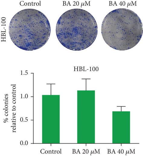 Ba Inhibits Breast Cancer Cell Proliferation And Metastasis A Ba