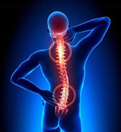 Back Pain: Causes, Symptoms, and Treatment 