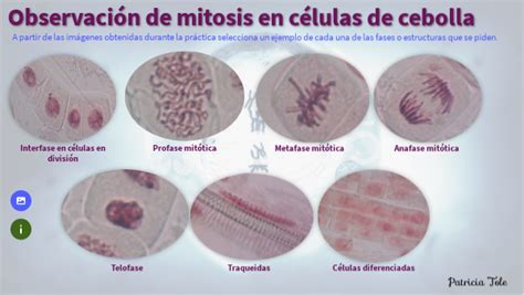 Pr Ctica De Mitosis De Cebolla Patricia Tole