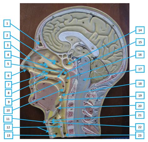 Respiratory Sagittal Head Model Labeled