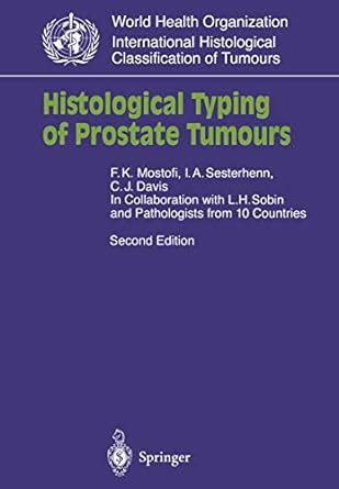 Amazon Histological Typing Of Prostate Tumours Who World Health