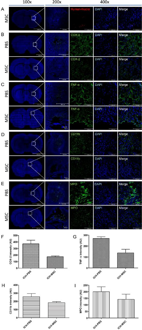 Typical Presence Of Hucb Mscs And Expression Of Inflammatory Factors