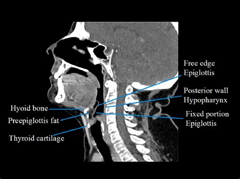 Hypopharynx And Larynx Anatomy Semantic Scholar