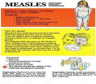 Dr Health Tips: Measles Virus Vaccine Symptoms,Causes,Home Natural ...