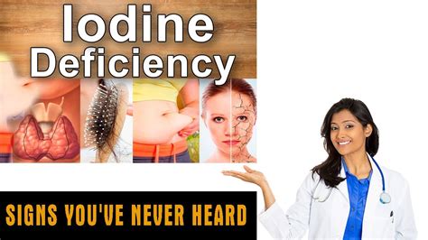 Iodine Deficiency Disorders Prevention You Ve Never Heard YouTube