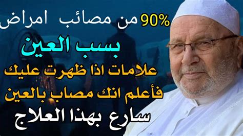 90 من مصائب امراض بسب العين علامات اذا ظهرت عليك فأعلم أنك مصاب