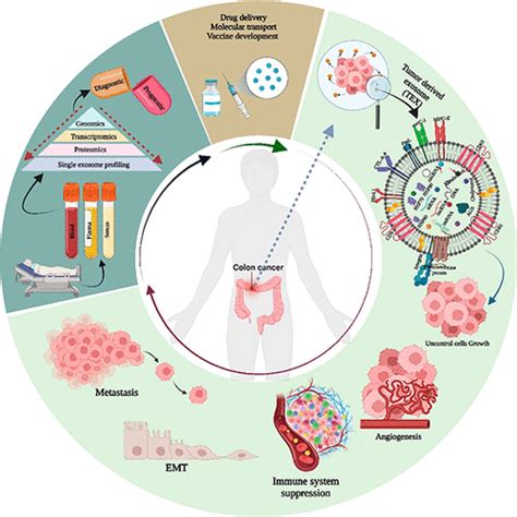 Clinical Impact Of Exosomes In Colorectal Cancer Metastasis Acs Applied Bio Materials