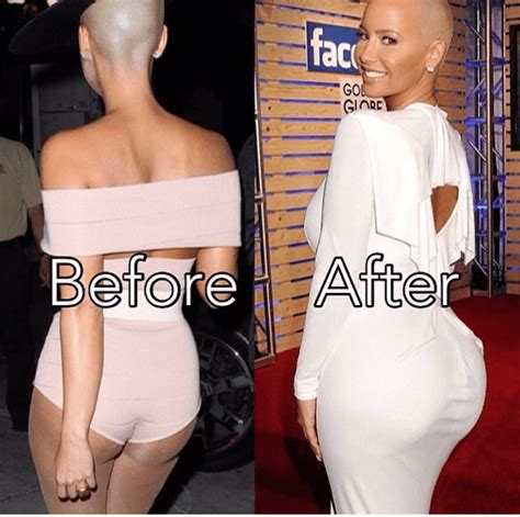 Amber Rose Butt Implant Plastic Surgery Butt Implants Celebrity