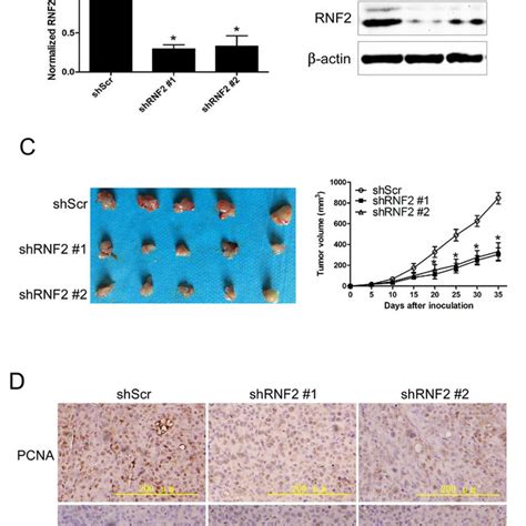 Knockdown Of RNF2 Inhibited The Growth Of PCa Xenograft In Nude Mice