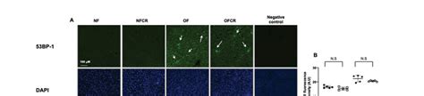 Liver Dna Double Strand Break Evaluation In The Nf Nfcr Of And Ofcr Download Scientific