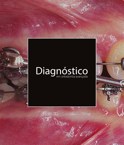 Diagn Stico Em Ortodontia Avan Ada By Dental Press International