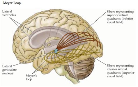 image result  meyers loop neuroscience radiation optical