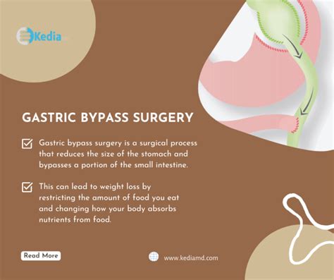 Gastric Bypass Surgery And Its Cons And Alternative Esg Dallas Tx