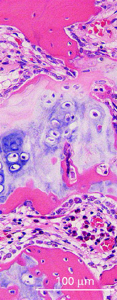 The Role Of Sex Hormones In The Kinetics Of Chondrocytes In The Growth