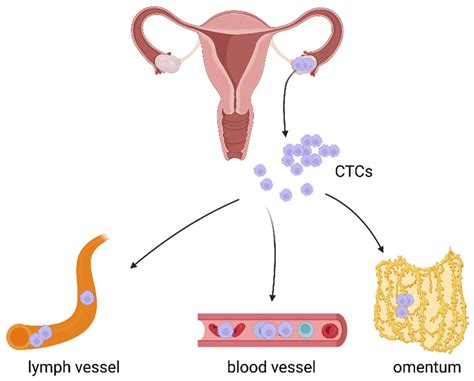 Cancers Free Full Text The Role Of Circulating Tumor Cells In