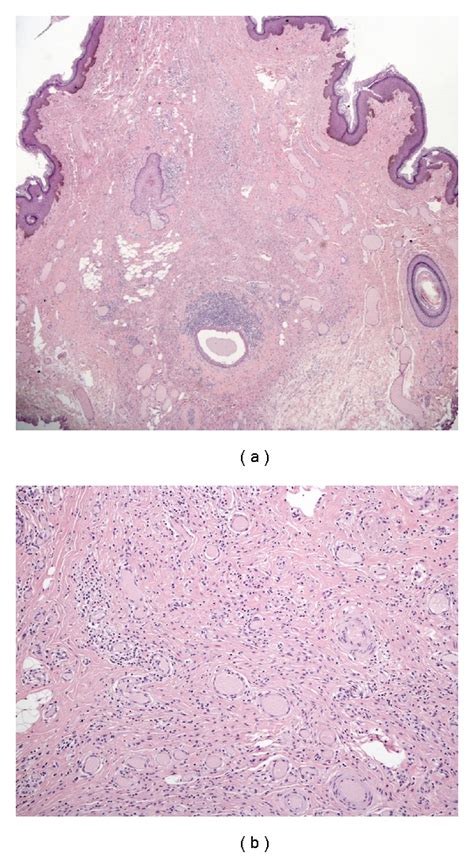 A Photomicrograph Hematoxylin Eosin Original Magnification ×2