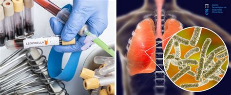 Legionella Pneumophila Pruebas Bioqu Micas En Laboratorio