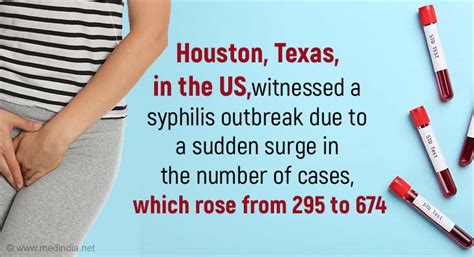 Syphilis Outbreak In Houston All You Need To Know About Alarming Rise