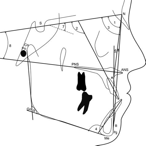 Angular Measurements 1 Sna 2 Maxillary Incisor Sn 3 Snb 4 Download Scientific