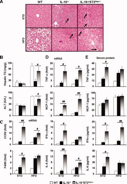 Hfd Induced Steatosis Liver Inflammatory Response And Injury Are