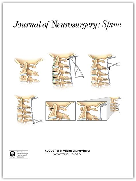 Biomechanical Comparison Of Lumbar Spine Instability Between Hot Sex