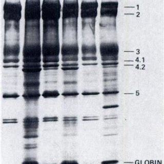 Transmission Electron Micrograph Of Rbc Membrane Skeleton From A Spx