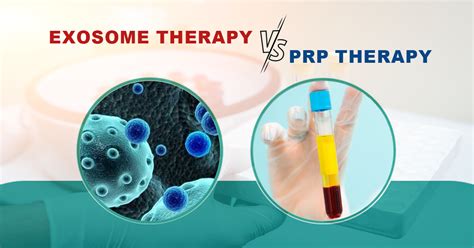 Exosomes Vs Platelet Rich Plasma Therapy Advancellsdiagnostics