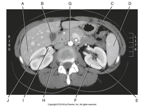 Ct Axial Anatomy L3 Level Diagram Quizlet