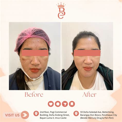 🌟 Before & After... - Beauty Couture Aesthetic Clinic