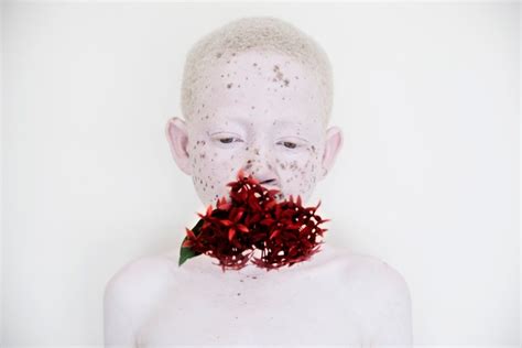 Albino child murders in Tanzania highlighted in photo series | Metro News