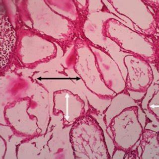 Histological Section Of The Rat Testicular Tissue In The Jujube Group