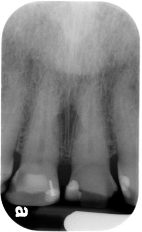 Anatomy Monday Top Anatomy Of 2013 Dr G S Toothpix