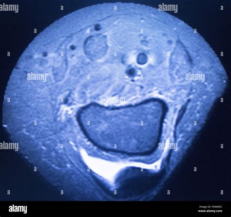 Mri Magnetic Resonance Imaging Medical Scan Test Results Showing