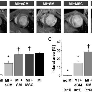 Quantification Of Infarct Size By MRI A Representative In Vivo T 1