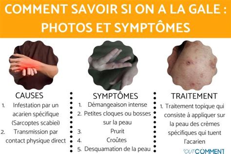 COMMENT SAVOIR si on a LA GALE PHOTOS et SYMPTÔMES