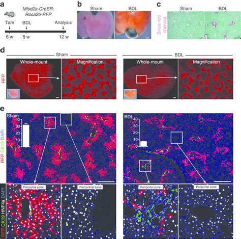 Reduction Of Pre Labelled Pp Hepatocytes After Injury Induced By Bdl