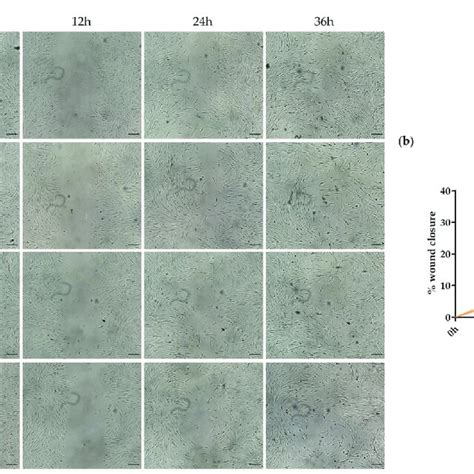 Scratch Wound Healing Assay In Human Adipose Derived Stem Cells HASCs