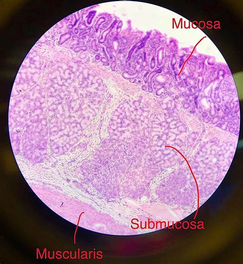 Duodenum Histology.