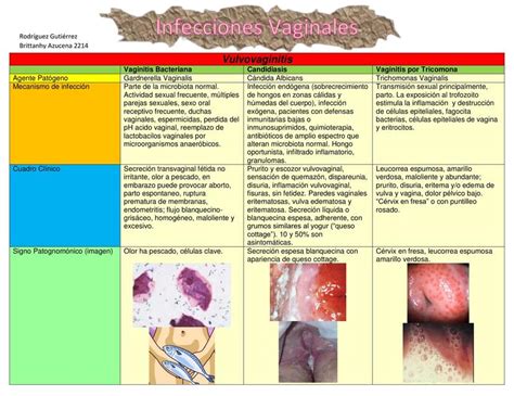 Infecciones Vaginales Integración Básico Clínica Medicina Humana