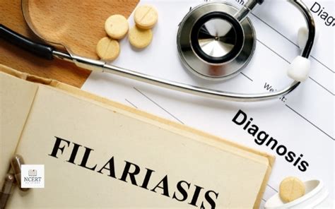 Filariasis: Symptoms, Causes and Treatment - NCERT Infrexa