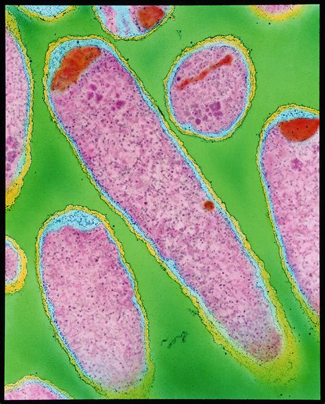 E Coli 0157h7 Bacteria Photograph By Dr Kari Lounatmaascience Photo Library Pixels