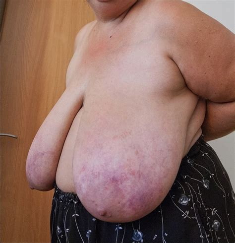 Bbw Mature Huge Boobs Slapping Ya Silly Porn Pictures XXX Photos Sex Images PICTOA