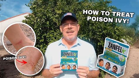 How To Treat A Poison Ivy Rash Quickly And Easily Youtube