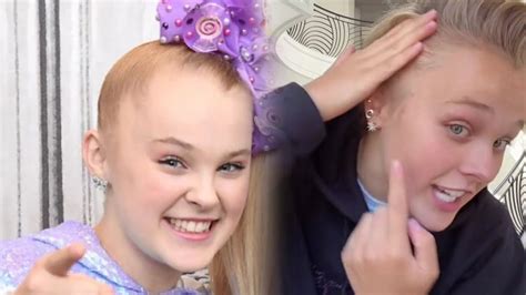 Jojo Siwa Explains Her Bald Spot Youtube