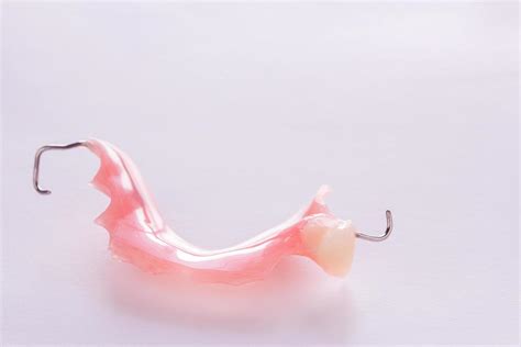 acrylic denture with metal clasps for restoring dentition 5516874 Stock ...