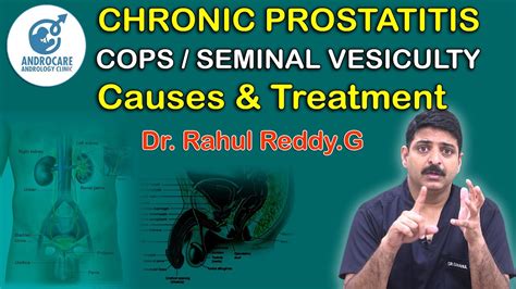 Chronic Prostatitis CPPS Seminal Vesiculitis Causes And Treatment Dr