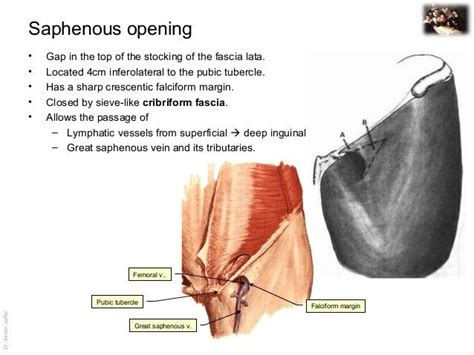 Saphenous Opening ... #femoral | Great saphenous vein, Fascia lata, Fascia