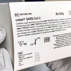 Roche Cobas® SARS-CoV-2 Test – Labcovid19